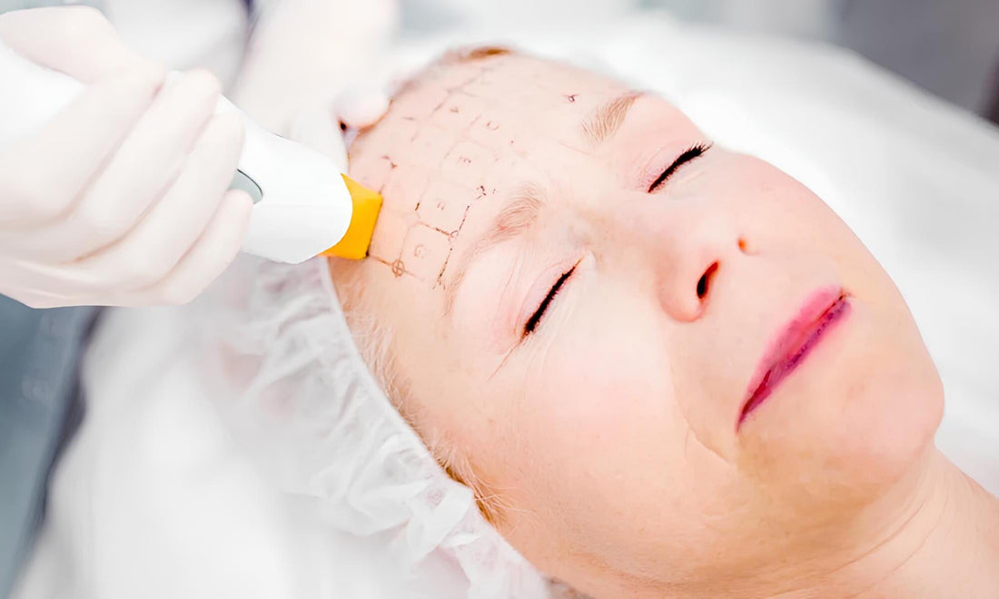 Will RF Beauty Tech Really Melt Your Facial Fat? The Truth Unveiled