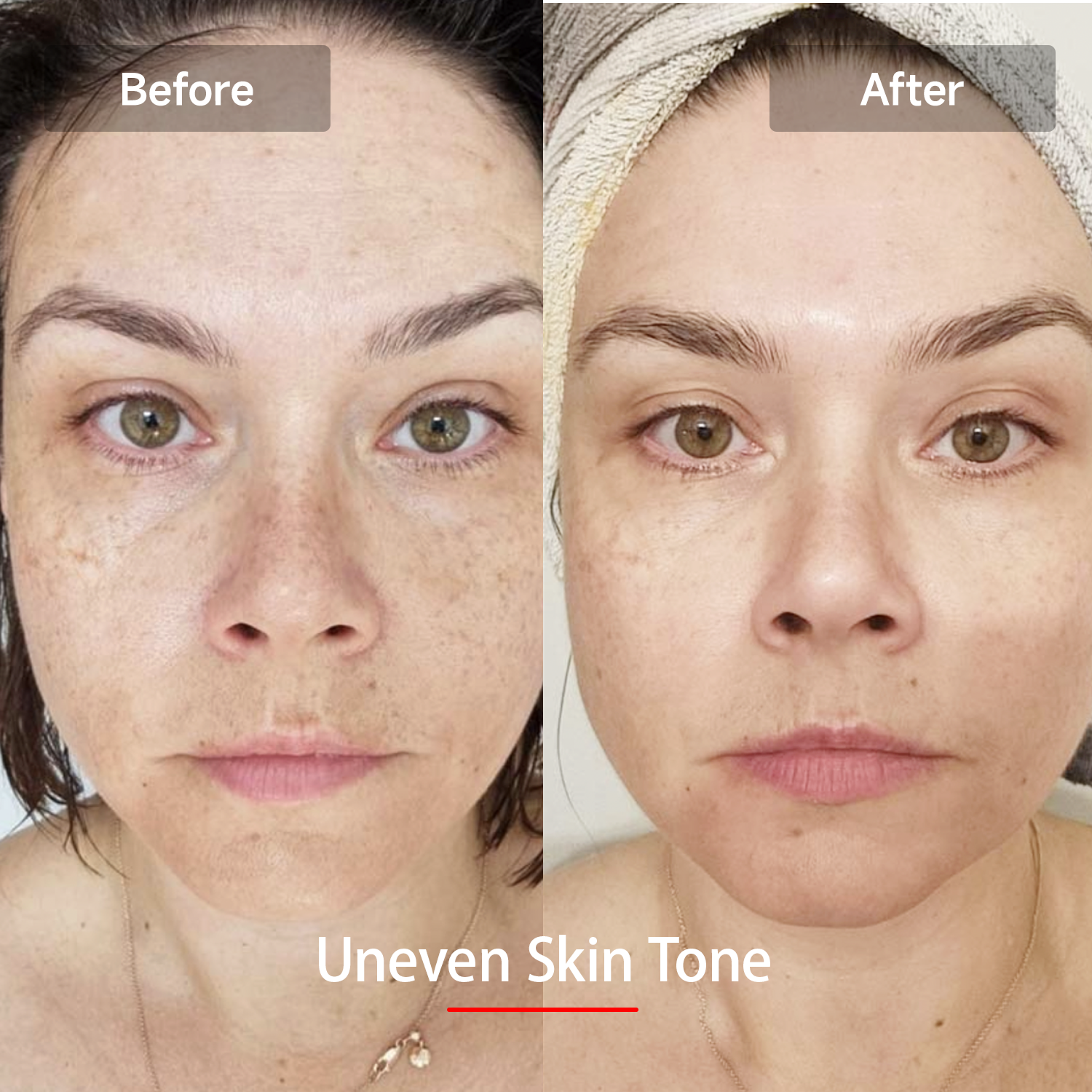 Megelin LED Red Light Therapy Mask - Megelin