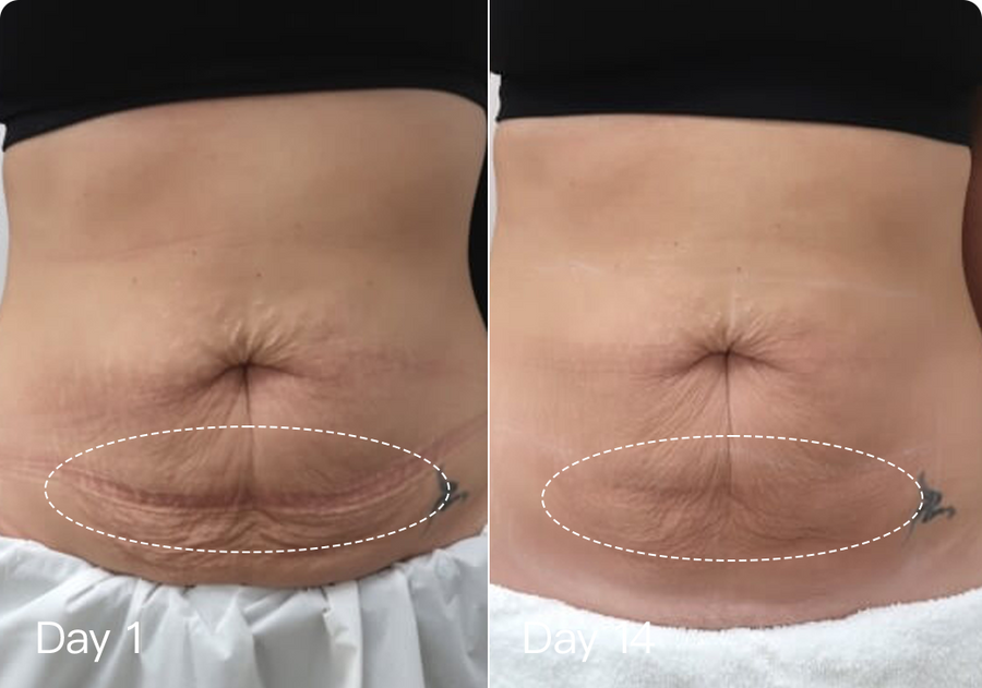 Individual results may vary as everyone's skin is unique and may respond differently to our products.