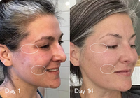 Megelin LED Red Light Therapy Face Mask - It can further improve your Wrinkles and Texture skin