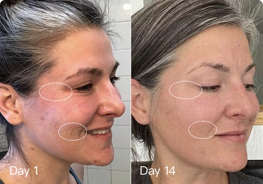 Megelin LED Red Light Therapy Face Mask - It can further improve your Wrinkles and Texture skin