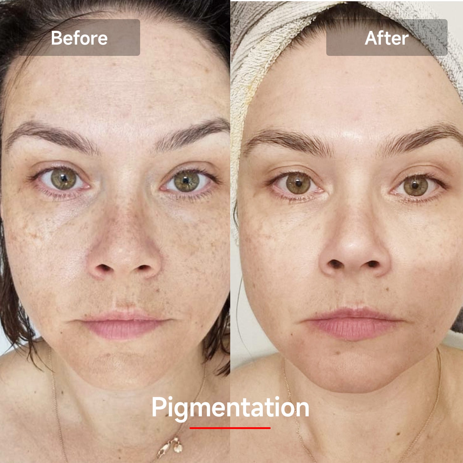 LED RED Light Therapy Mask - Megelin