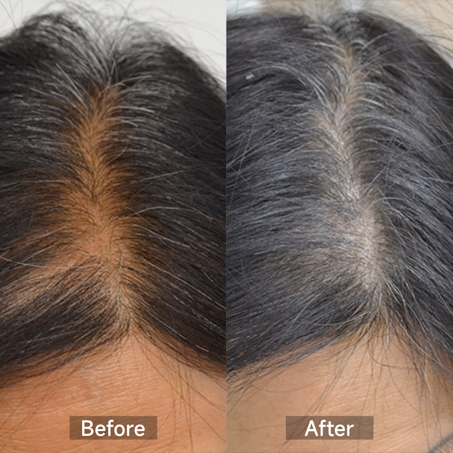 GrowLux Laser+LED Cap - Megelin