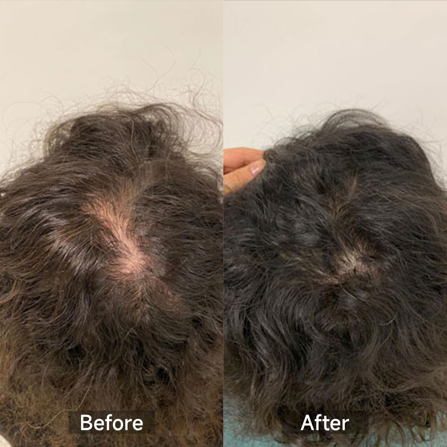 GrowLux Laser+LED Cap - Megelin