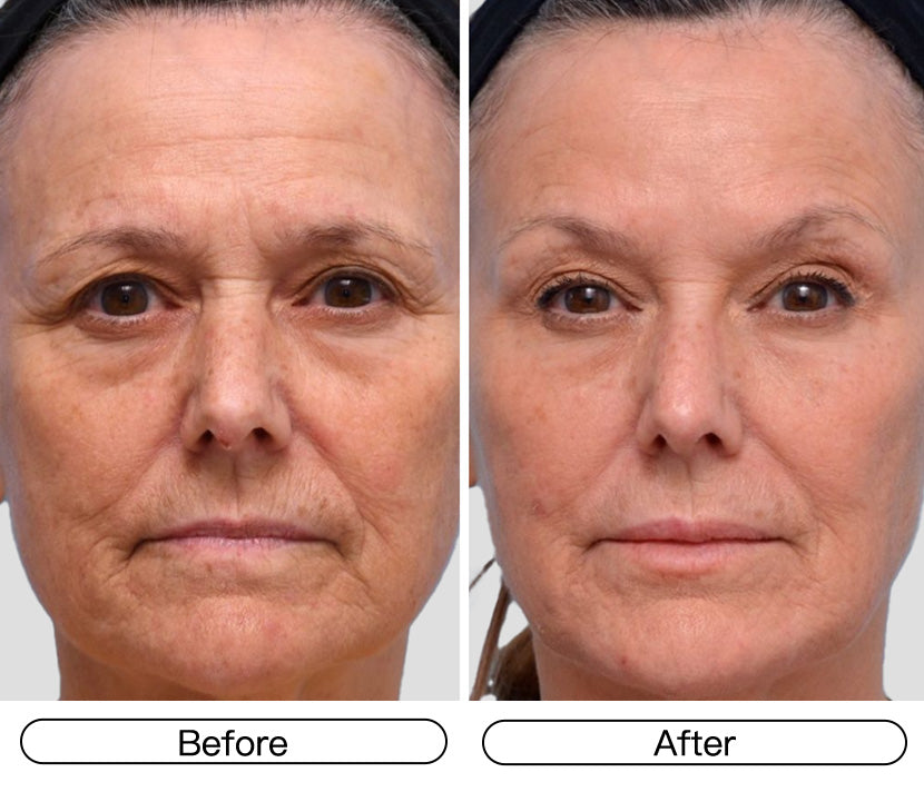 Noticeably Firmer, Smoother Skin in Just 4 Weeks.