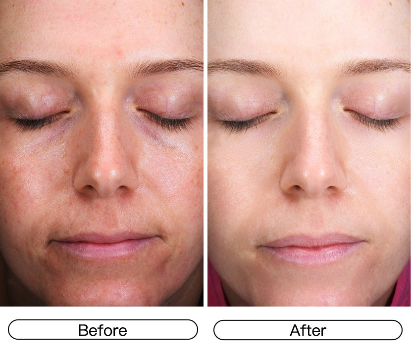 Dullness Gone, Radiance Restored.