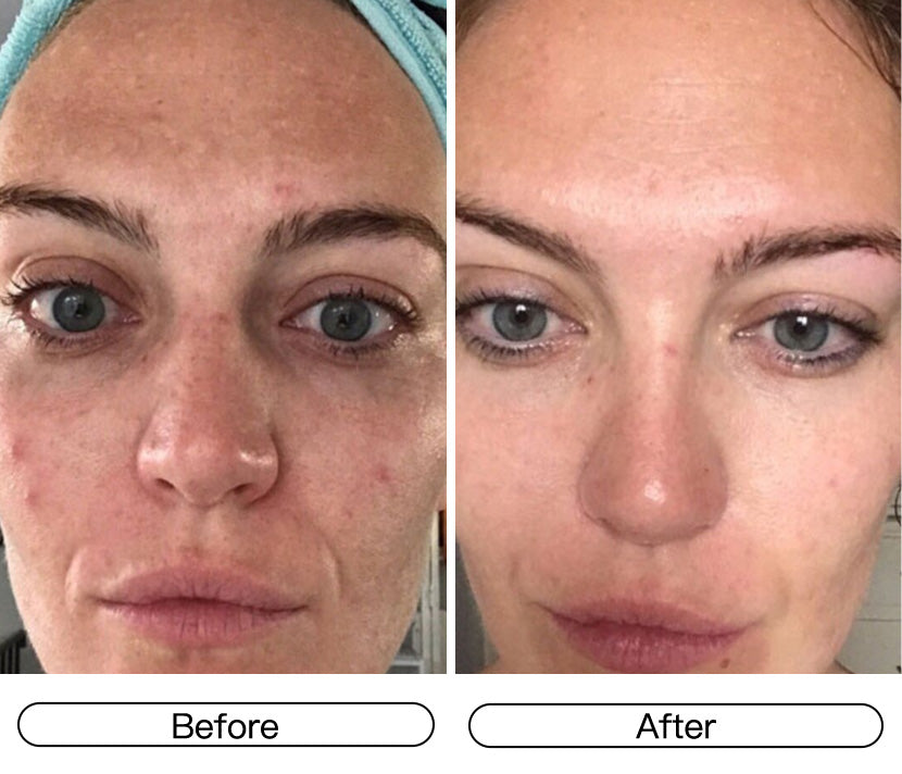 Fade Dark Spots: Brighten and Even Out Skin Tone in 3 Weeks.