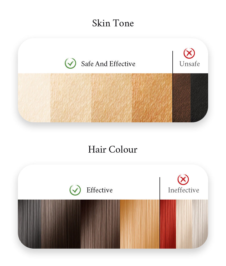 Will Megelin IPL Work For Me?