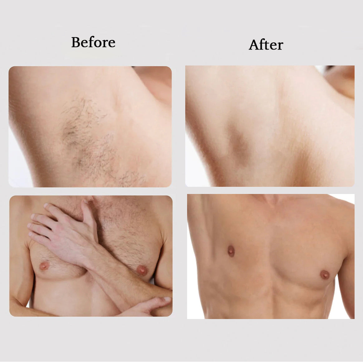 Free Megelin M1 IPL Hair Removal - Megelin