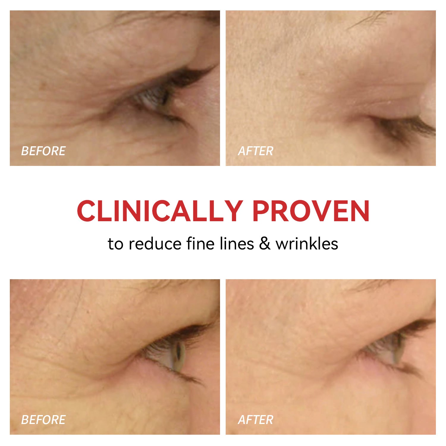 Red Light Therapy for Eyes - Megelin