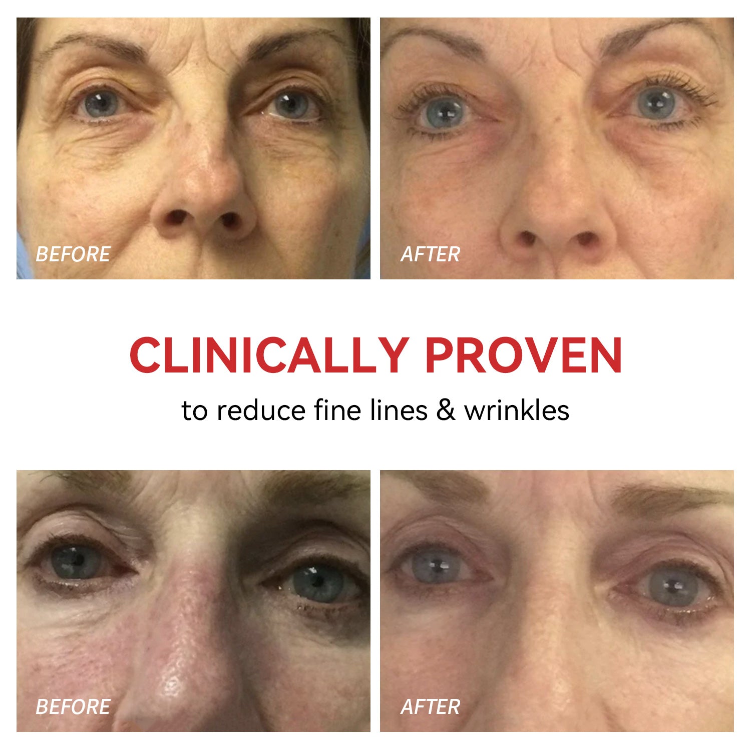 Red Light Therapy for Eyes - Megelin