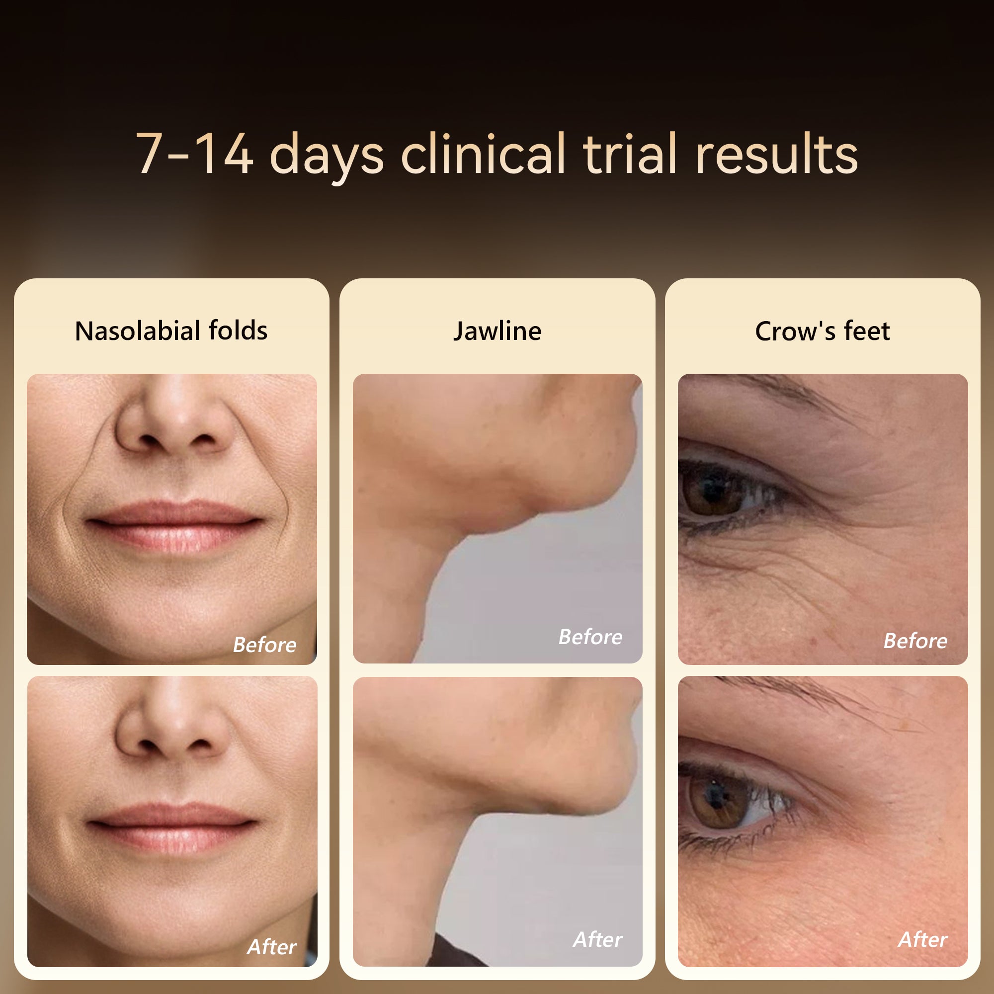 Free RF Anti Aging Device - Megelin