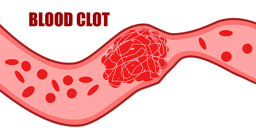 How Red Light Therapy Can Help with Blood Clots