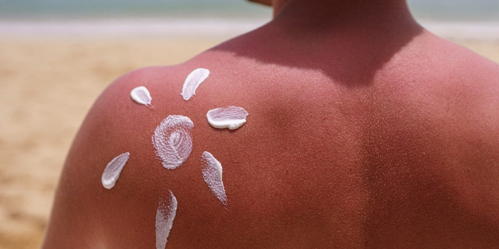 Top Strategies on How to Prevent Skin Cancer After a Bad Sunburn