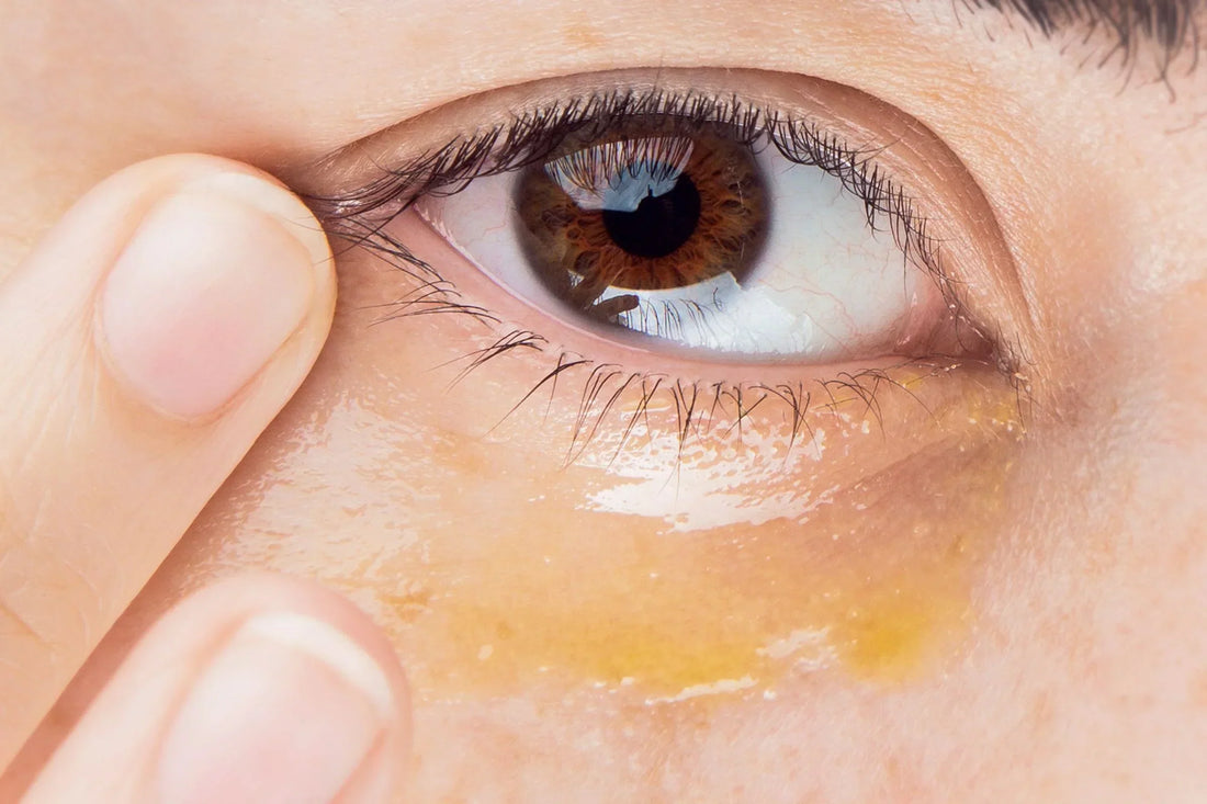 Best Red Light Therapy Devices for Under Eyes: A Complete Guide