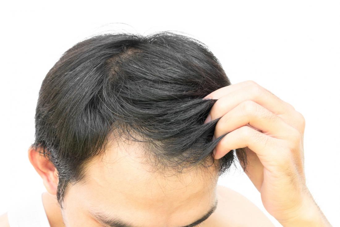 The Best Red Light Therapy Devices for Hair Growth in 2025: A Comprehensive Review