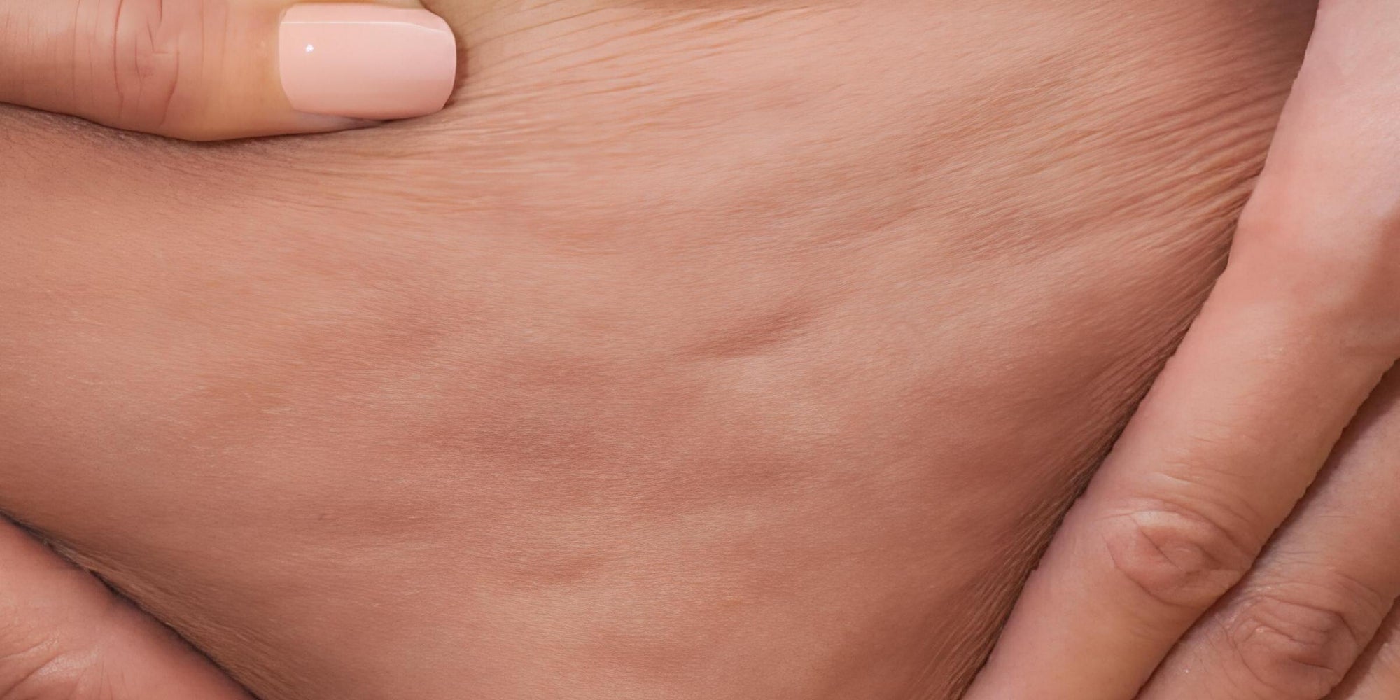 Red Light Therapy For Cellulite 50 Users Results Before and After