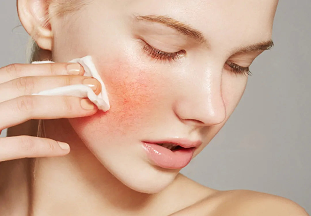 Skin Barrier Repair: Why It’s Crucial and How LED Therapy Helps