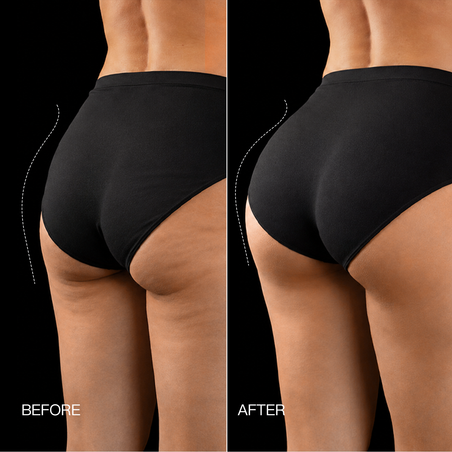 Megelin EMS Toning Shorts