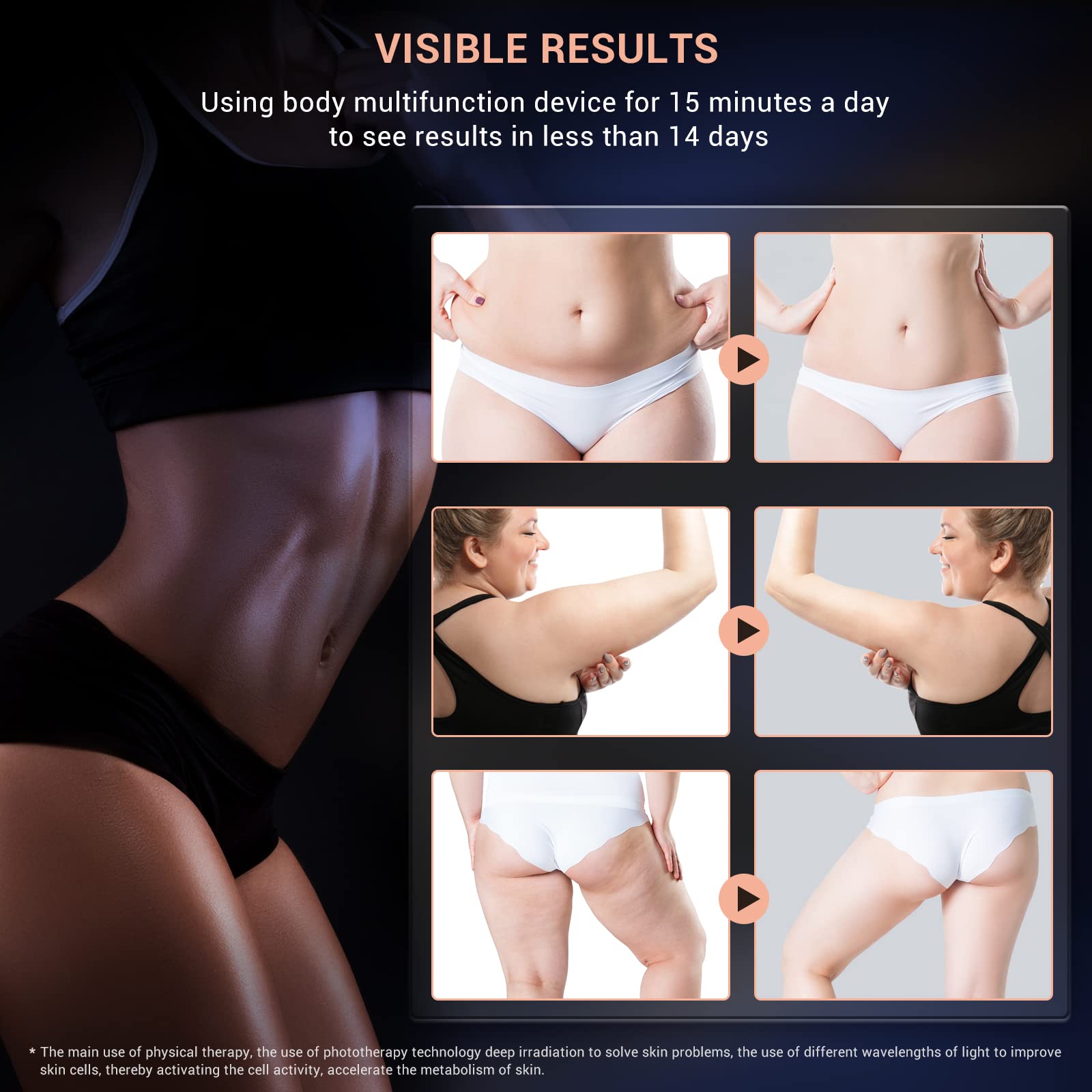 Megelin At-Home Body Fat Slimming &amp; Skin Tightening Device