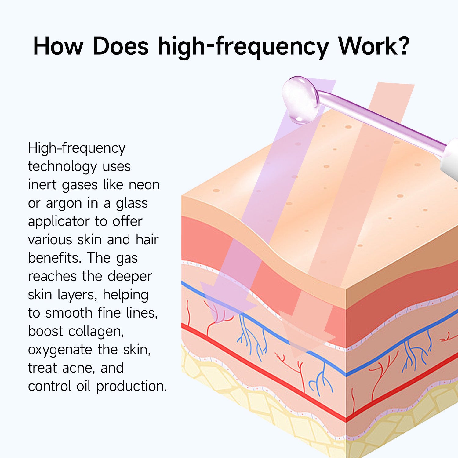 Megelin High Frequency Wand | Megelin